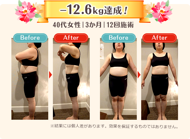 -12.6kg達成した女性のビフォーアフター